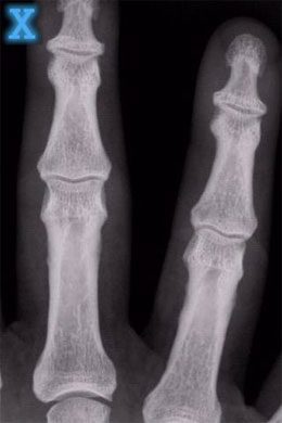 X-Ray Scanner – 엑스레이 스캐너 1.7.5 1